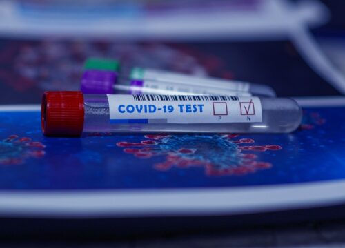 Nieodpłatne testy na COVID-19 dla pracowników i weryfikacja szczepień. Projekt ustawy już w Sejmie